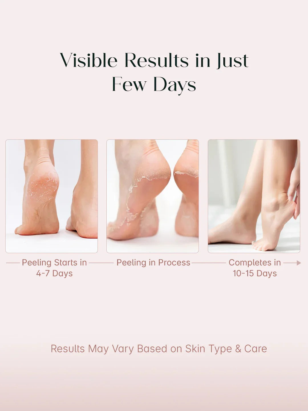 GLYCOLIC AND NIACINAMIDE FOOT PEELING MASK